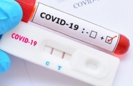 Reportan 40 nuevos casos de coronavirus en Salto