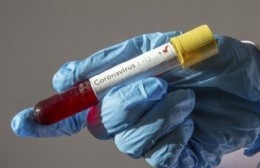 Siguen en baja los casos activos de coronavirus y confirman tres nuevas muertes