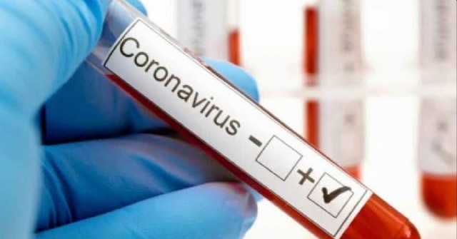 En Salto comienzan a alivianar la situación del coronavirus con 230 casos descartados